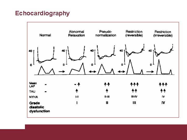 Echocardiography Congestive Heart Failure 26/11/2020 Pagina 34 