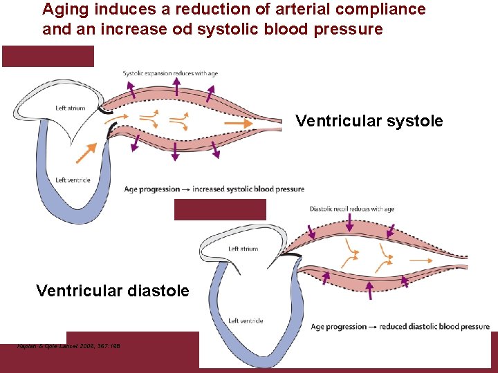 Aging induces a reduction of arterial compliance and an increase od systolic blood pressure