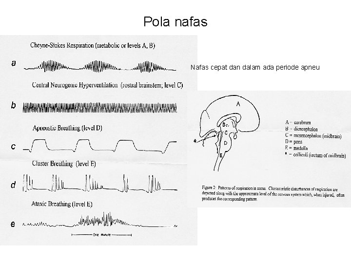 Pola nafas Nafas cepat dan dalam ada periode apneu 