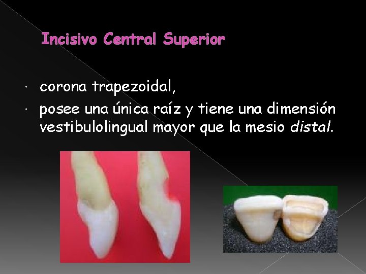 Incisivo Central Superior corona trapezoidal, posee una única raíz y tiene una dimensión vestibulolingual Incisivo Central Superior corona trapezoidal, posee una única raíz y tiene una dimensión vestibulolingual