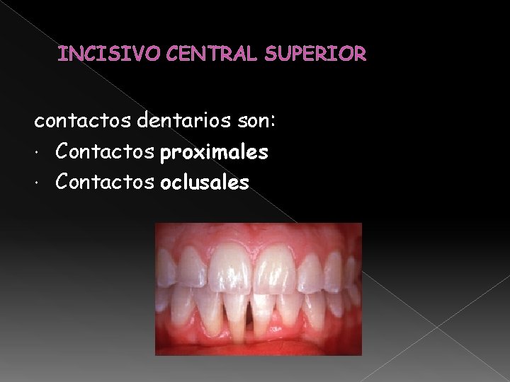 INCISIVO CENTRAL SUPERIOR contactos dentarios son: Contactos proximales Contactos oclusales INCISIVO CENTRAL SUPERIOR contactos dentarios son: Contactos proximales Contactos oclusales