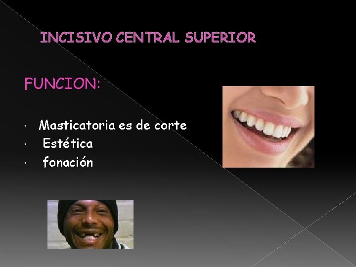 INCISIVO CENTRAL SUPERIOR FUNCION: Masticatoria es de corte Estética fonación INCISIVO CENTRAL SUPERIOR FUNCION: Masticatoria es de corte Estética fonación