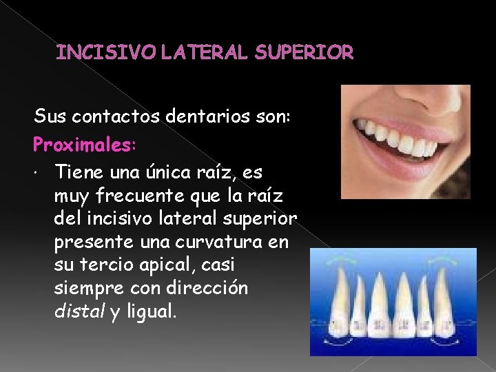 INCISIVO LATERAL SUPERIOR Sus contactos dentarios son: Proximales: Tiene una única raíz, es muy INCISIVO LATERAL SUPERIOR Sus contactos dentarios son: Proximales: Tiene una única raíz, es muy
