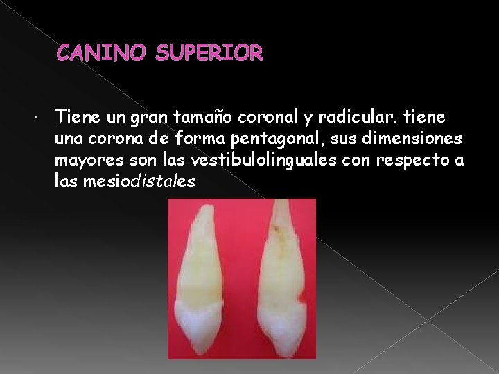 CANINO SUPERIOR Tiene un gran tamaño coronal y radicular. tiene una corona de forma CANINO SUPERIOR Tiene un gran tamaño coronal y radicular. tiene una corona de forma