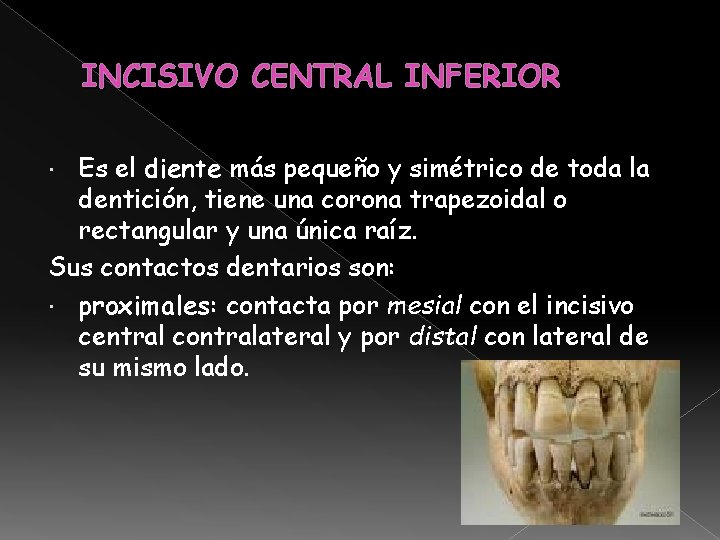 INCISIVO CENTRAL INFERIOR Es el diente más pequeño y simétrico de toda la dentición, INCISIVO CENTRAL INFERIOR Es el diente más pequeño y simétrico de toda la dentición,