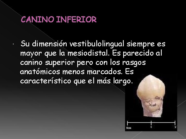 CANINO INFERIOR Su dimensión vestibulolingual siempre es mayor que la mesiodistal. Es parecido al CANINO INFERIOR Su dimensión vestibulolingual siempre es mayor que la mesiodistal. Es parecido al