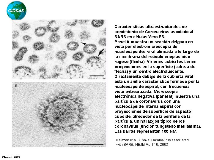 GIDSAS Características ultraestructurales de crecimiento de Coronavirus asociado al SARS en células Vero E