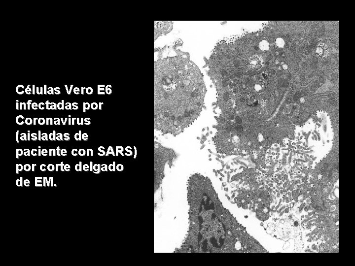 Células Vero E 6 infectadas por Coronavirus (aisladas de paciente con SARS) por corte