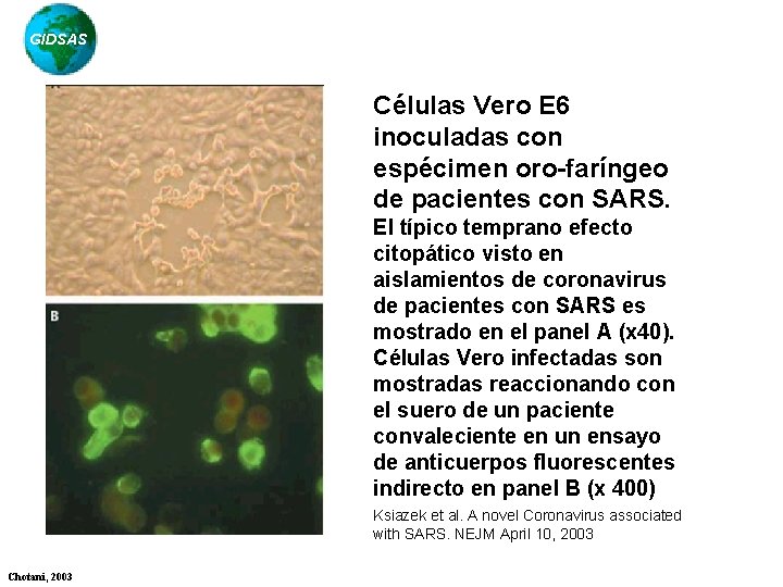 GIDSAS Células Vero E 6 inoculadas con espécimen oro-faríngeo de pacientes con SARS. El