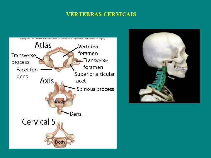 VÉRTEBRAS CERVICAIS 