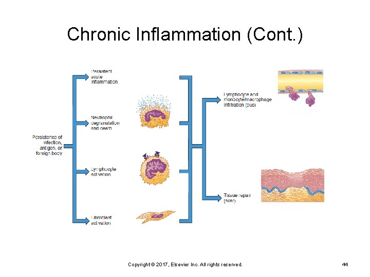 Chronic Inflammation (Cont. ) Copyright © 2017, Elsevier Inc. All rights reserved. 44 
