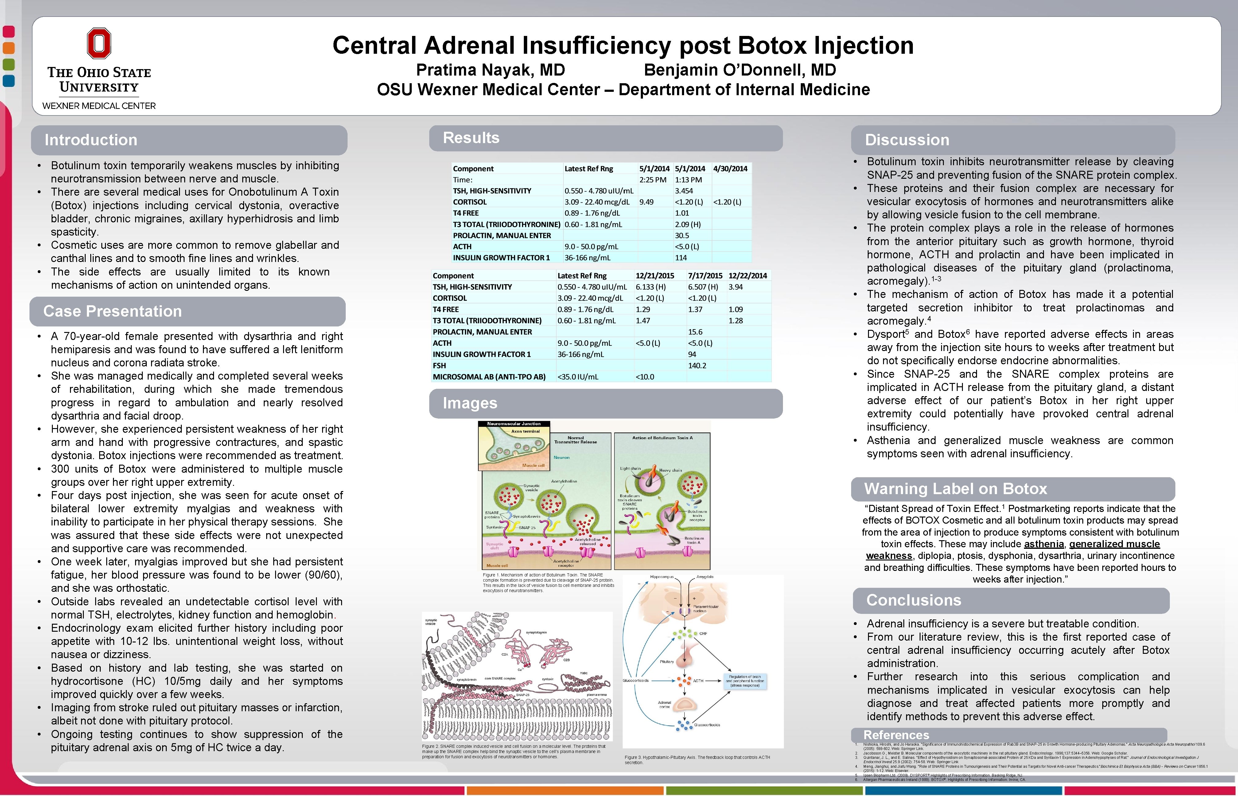 Central Adrenal Insufficiency post Botox Injection Pratima Nayak, MD Benjamin O’Donnell, MD OSU Wexner