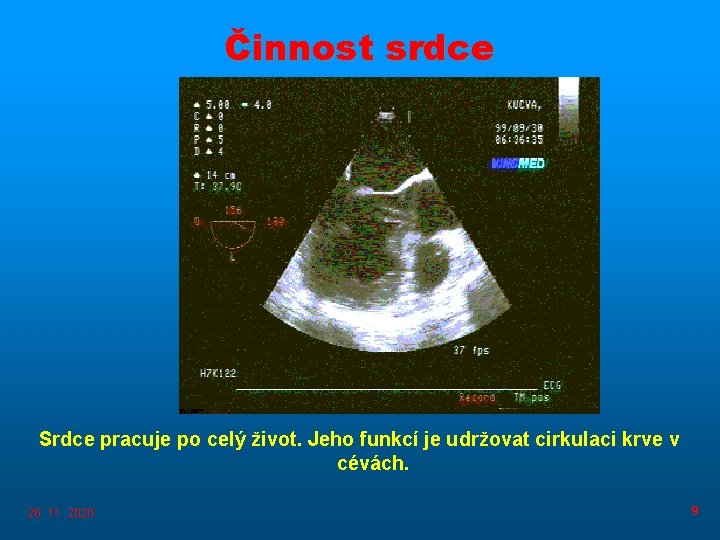 Činnost srdce Srdce pracuje po celý život. Jeho funkcí je udržovat cirkulaci krve v