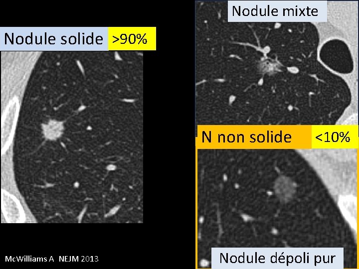 Nodule mixte Nodule solide >90% N non solide Mc. Williams A NEJM 2013 <10%