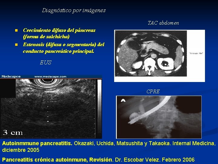 Diagnóstico por imágenes TAC abdomen n n Crecimiento difuso del páncreas (forma de salchicha)