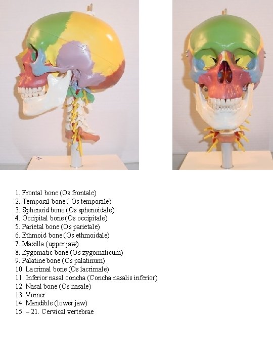 1. Frontal bone (Os frontale) 2. Temporal bone ( Os temporale) 3. Sphenoid bone