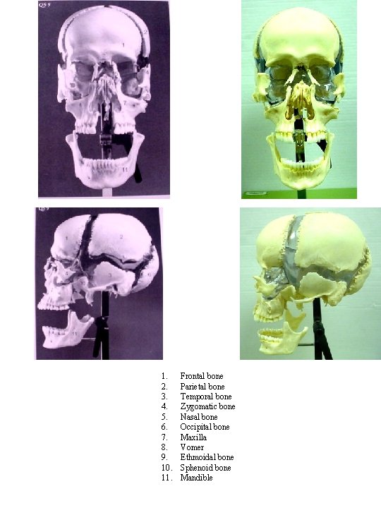 1. 2. 3. 4. 5. 6. 7. 8. 9. 10. 11. Frontal bone Parietal