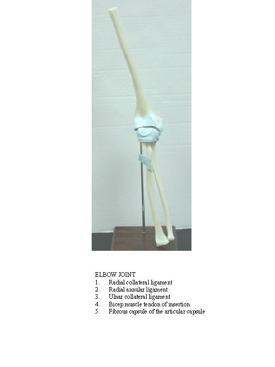 ELBOW JOINT 1. Radial collateral ligament 2. Radial annular ligament 3. Ulnar collateral ligament
