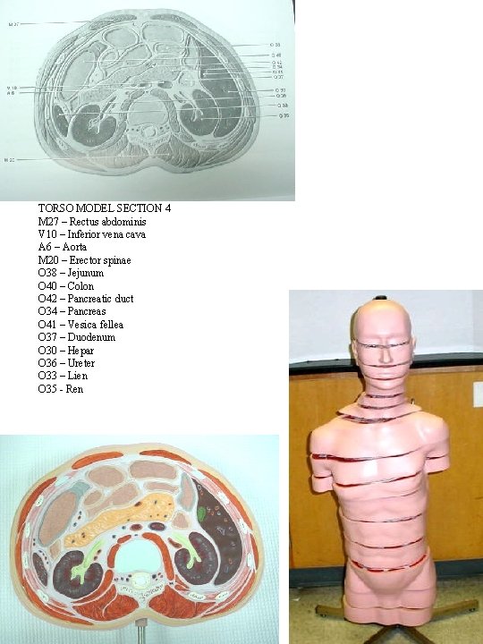 TORSO MODEL SECTION 4 M 27 – Rectus abdominis V 10 – Inferior vena