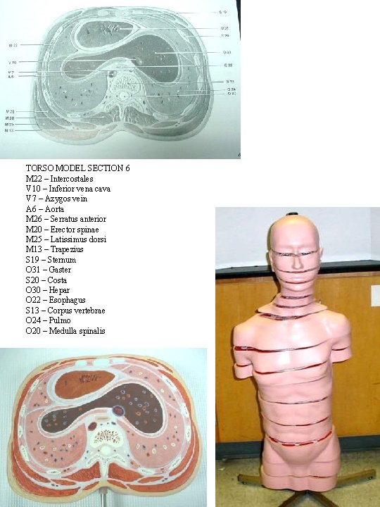 TORSO MODEL SECTION 6 M 22 – Intercostales V 10 – Inferior vena cava