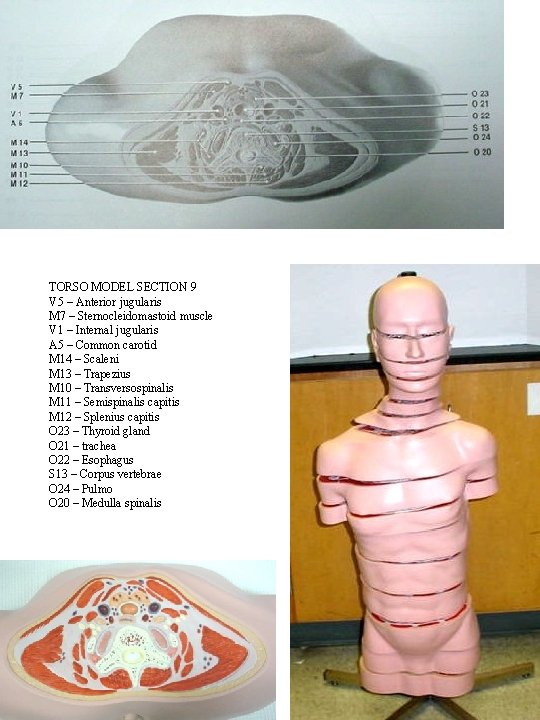 TORSO MODEL SECTION 9 V 5 – Anterior jugularis M 7 – Sternocleidomastoid muscle