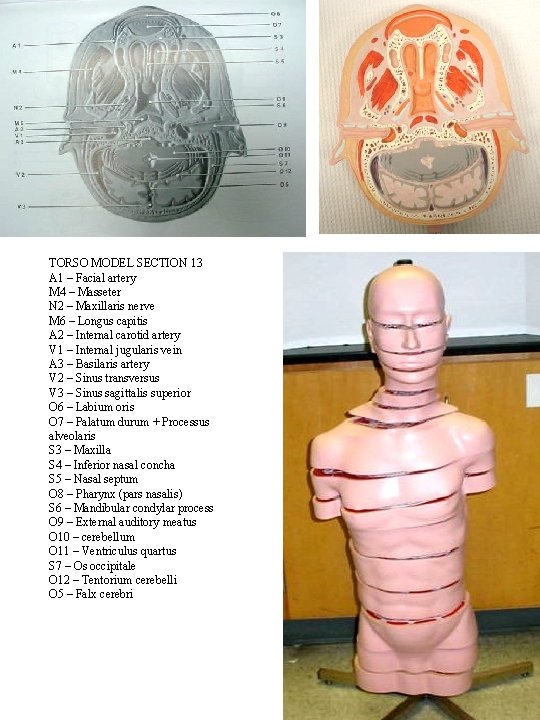 TORSO MODEL SECTION 13 A 1 – Facial artery M 4 – Masseter N