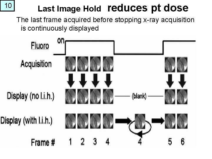 10 Last Image Hold reduces pt dose The last frame acquired before stopping x-ray