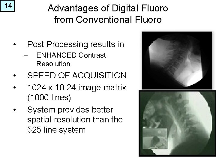 14 Advantages of Digital Fluoro from Conventional Fluoro • Post Processing results in –
