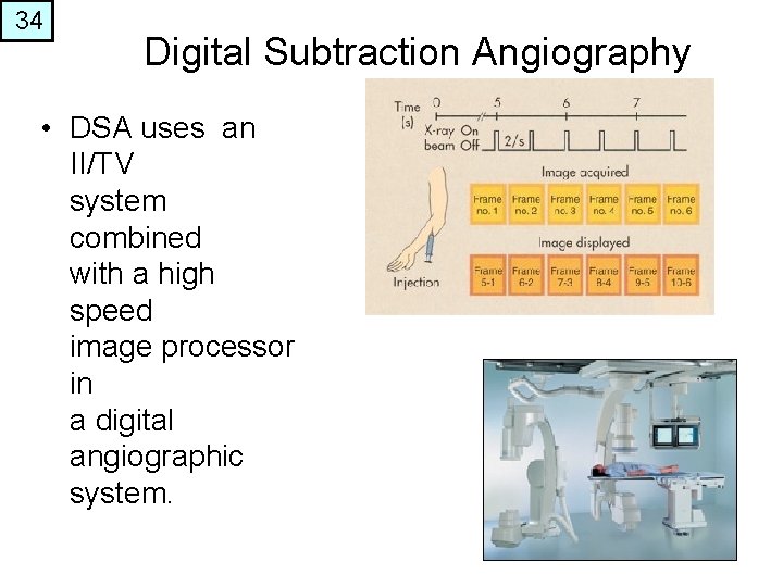 34 Digital Subtraction Angiography • DSA uses an II/TV system combined with a high