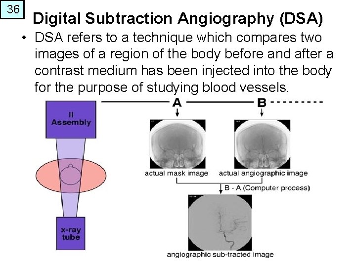 36 Digital Subtraction Angiography (DSA) • DSA refers to a technique which compares two