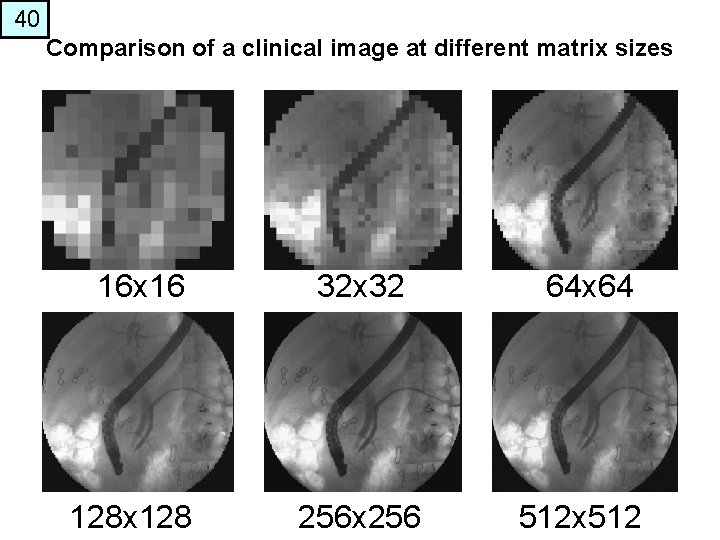 40 Comparison of a clinical image at different matrix sizes 16 x 16 32