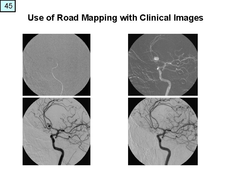 45 Use of Road Mapping with Clinical Images • . 