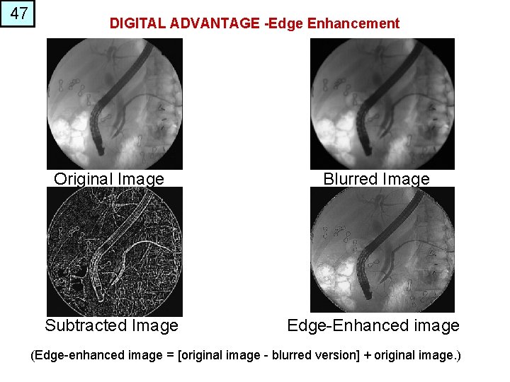 47 DIGITAL ADVANTAGE -Edge Enhancement Original Image Blurred Image Subtracted Image Edge-Enhanced image (Edge-enhanced