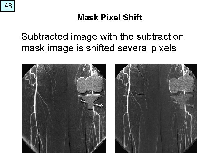 48 Mask Pixel Shift Subtracted image with the subtraction mask image is shifted several