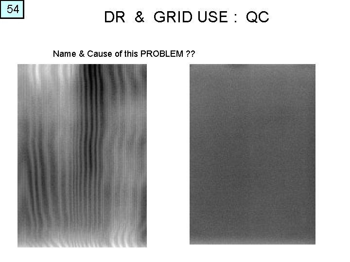 54 DR & GRID USE : QC Name & Cause of this PROBLEM ?