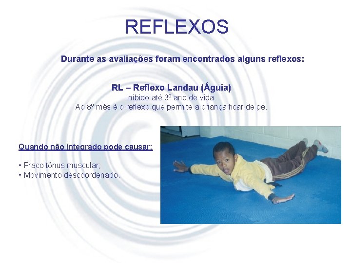 REFLEXOS Durante as avaliações foram encontrados alguns reflexos: RL – Reflexo Landau (Águia) Inibido