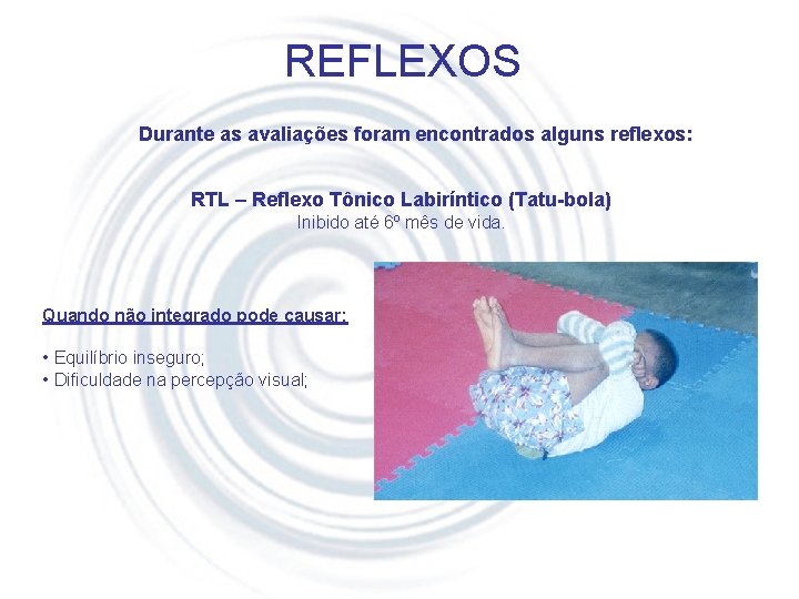 REFLEXOS Durante as avaliações foram encontrados alguns reflexos: RTL – Reflexo Tônico Labiríntico (Tatu-bola)