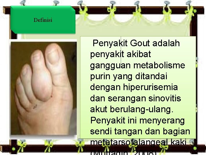 Definisi Penyakit Gout adalah penyakit akibat gangguan metabolisme purin yang ditandai dengan hiperurisemia dan