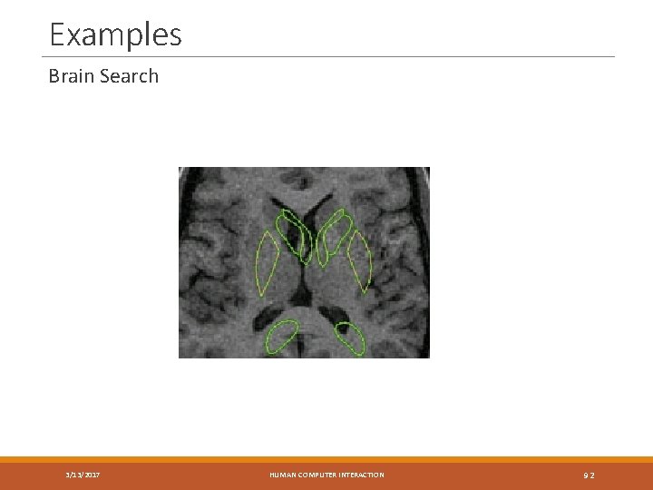 Examples Brain Search 3/13/2017 HUMAN COMPUTER INTERACTION 92 