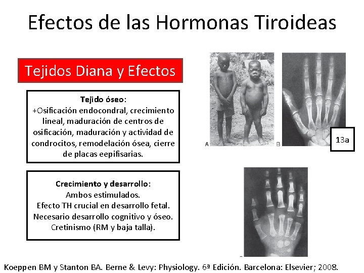 Efectos de las Hormonas Tiroideas Tejidos Diana y Efectos Tejido óseo: +Osificación endocondral, crecimiento
