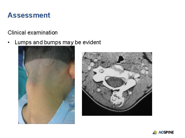 Assessment Clinical examination • Lumps and bumps may be evident 
