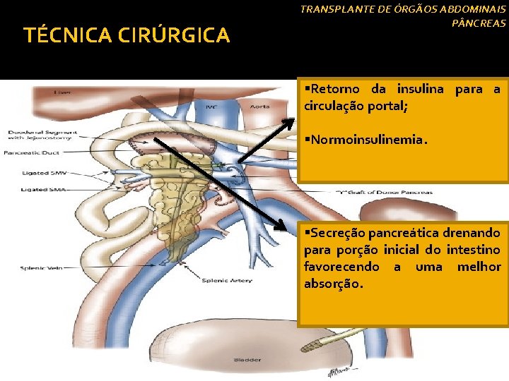 TÉCNICA CIRÚRGICA Drenagem Venosa § Drenagem Venosa Portal: TRANSPLANTE DE ÓRGÃOS ABDOMINAIS P NCREAS