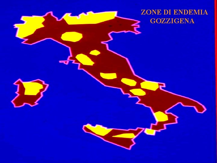 ZONE DI ENDEMIA GOZZIGENA 