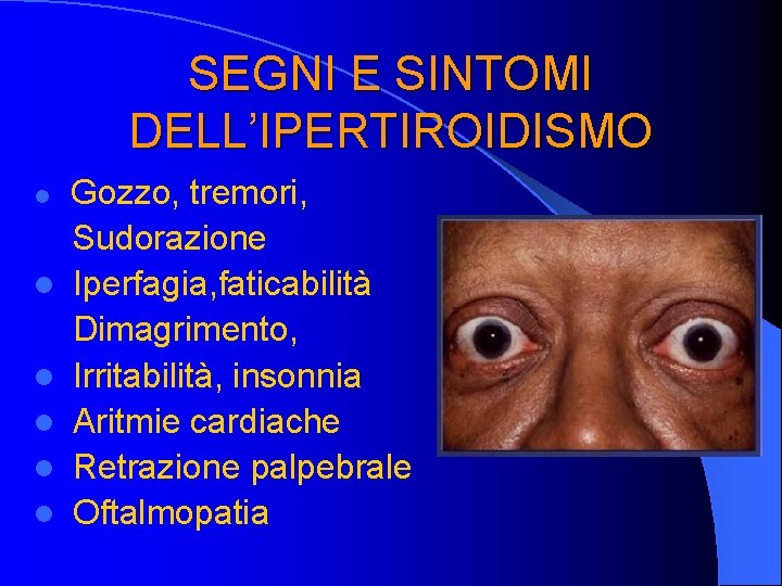 SEGNI E SINTOMI DELL’IPERTIROIDISMO l l l Gozzo, tremori, Sudorazione Iperfagia, faticabilità Dimagrimento, Irritabilità,