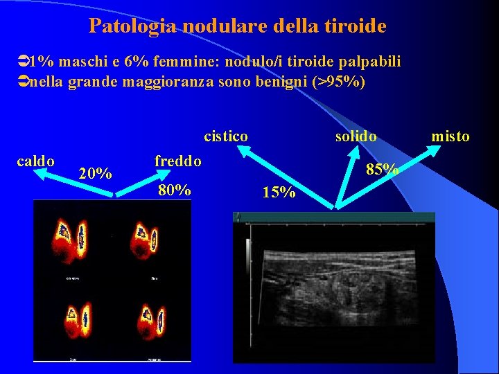 Patologia nodulare della tiroide Ü 1% maschi e 6% femmine: nodulo/i tiroide palpabili Ünella