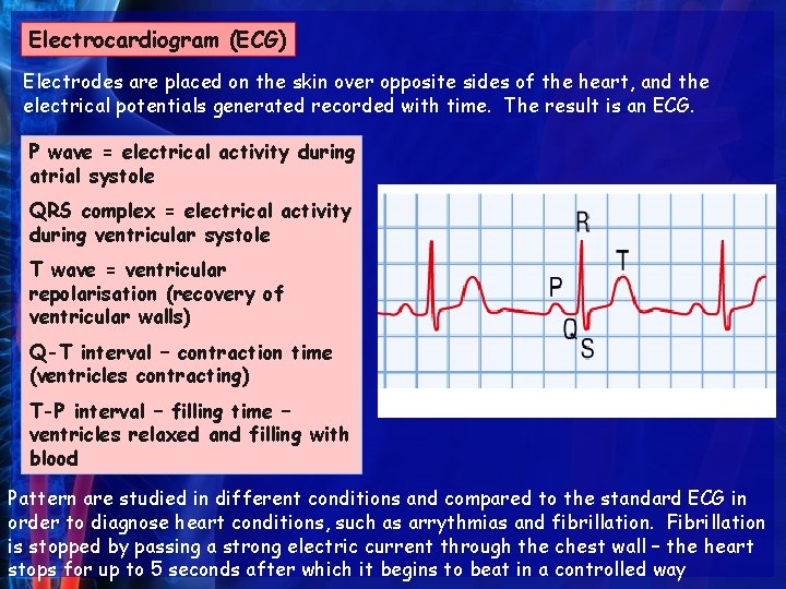 Electrocardiogram (ECG) Electrodes are placed on the skin over opposite sides of the heart,