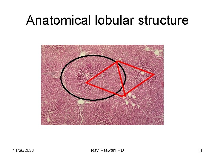 Anatomical lobular structure 11/26/2020 Ravi Vaswani MD 4 