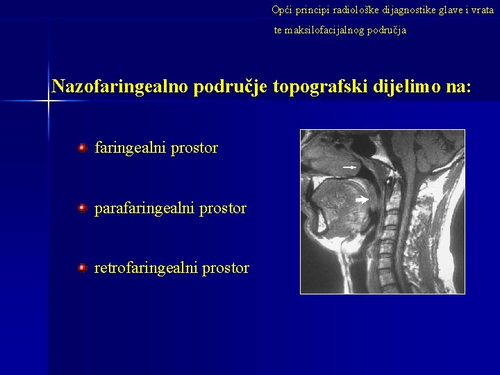 Opći principi radiološke dijagnostike glave i vrata te maksilofacijalnog područja Nazofaringealno područje topografski dijelimo