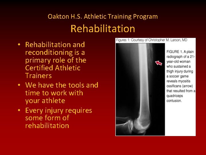 Oakton H. S. Athletic Training Program Rehabilitation • Rehabilitation and reconditioning is a primary