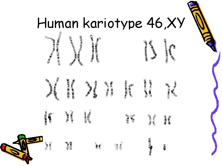 Human kariotype 46, XY 
